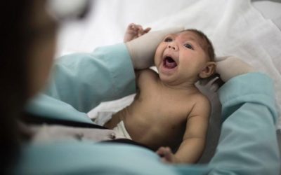 Zika menyebabkan pengecilan kepala pada bayi.  (telegraph.co.uk)